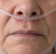 Discomfort from a traditional oxygen cannula