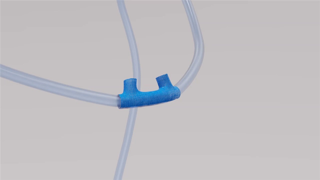 NoMoRa cannula cover on tubing